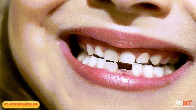 Mộng thấy rụng răng hàm dưới